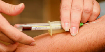 blood test to diagnose type 2 diabetes