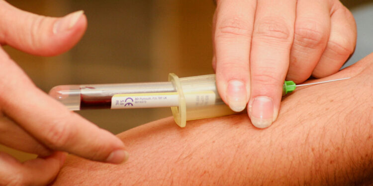 blood test to diagnose type 2 diabetes
